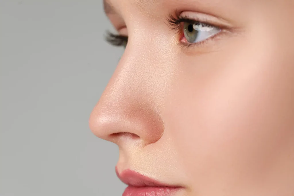Nose Job